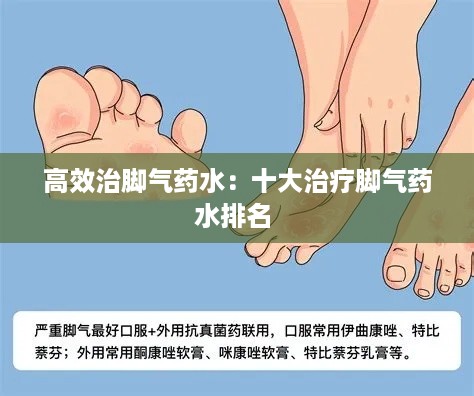 高效治脚气药水:十大治疗脚气药水排名