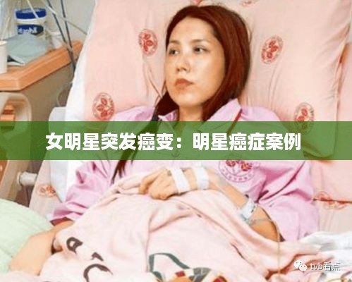 女明星突发癌变:明星癌症案例